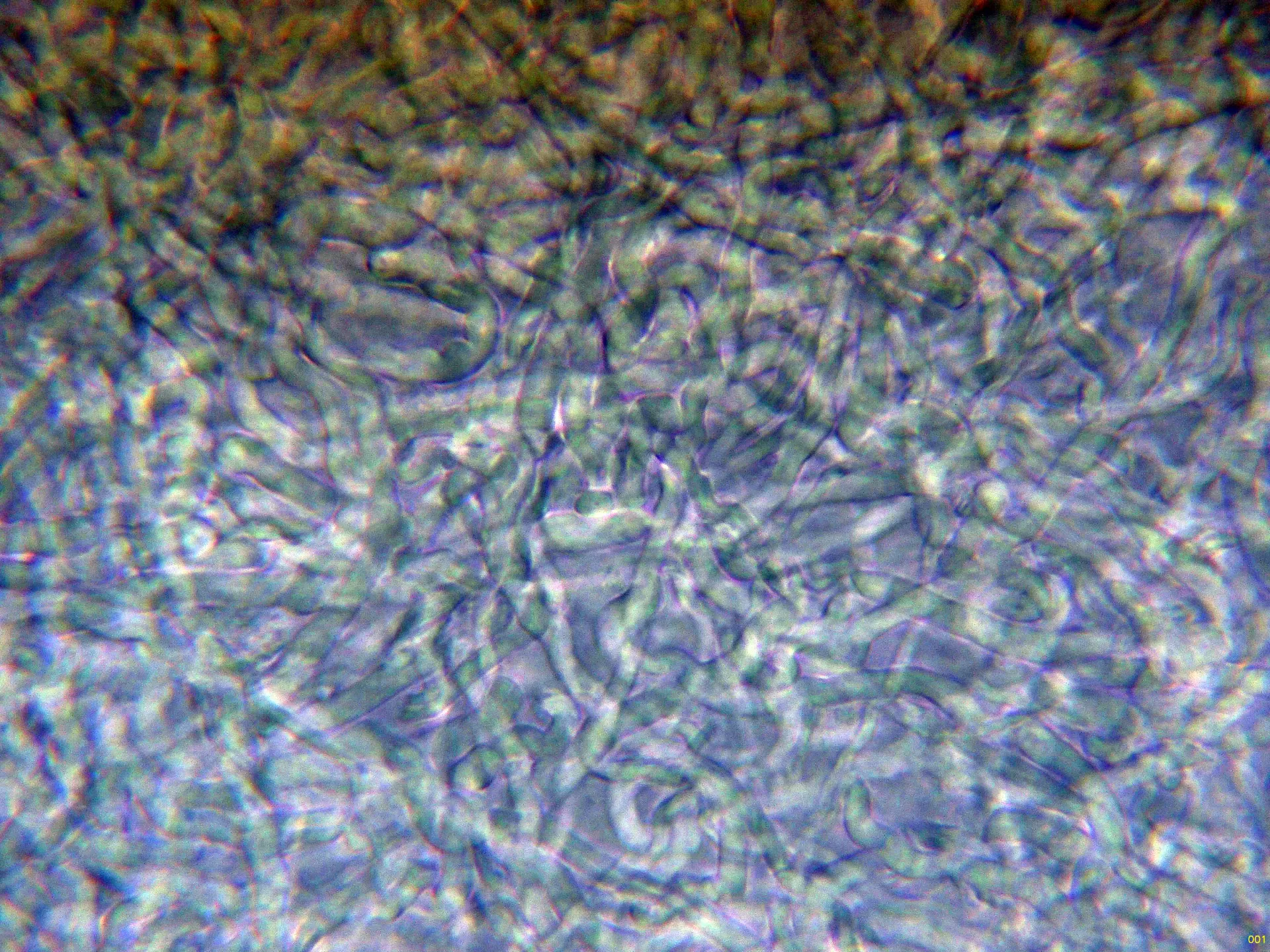 Microscopía de Picipes badius - 10 - Subpellis agua-001